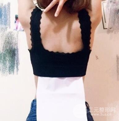 腹部吸脂后出现凹陷怎么办?腹部吸脂影响怀孕生孩子吗?