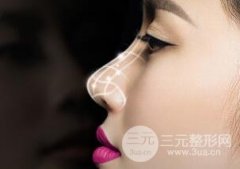 膨体隆鼻可以长时间不取出吗? 膨体隆鼻可以长时间不取出吗?