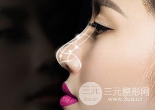 膨体隆鼻可以长时间不取出吗?