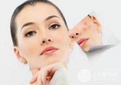 激光去痘坑一共要做几次？