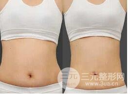 腰腹吸脂果明X吗? 腰腹吸脂果明X吗?