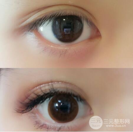 睫毛种植术前需要做哪些准备？