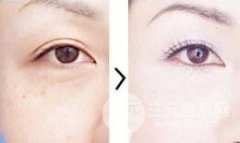 睫毛种植过程是什么样的呢？