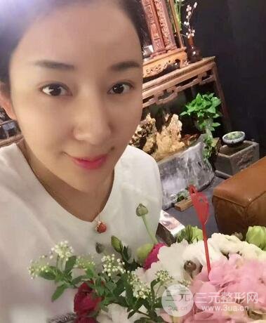 全脸线D图片 线D恢复过程图片