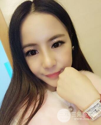 假体隆鼻恢复过程实例 前后果对比