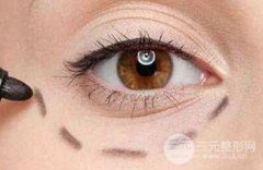 眼袋吸脂的果如何？