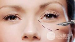 激光去眼袋要几次才能祛除呢？