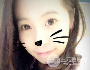 真人内切去眼袋手术过程对比图片和案例分享