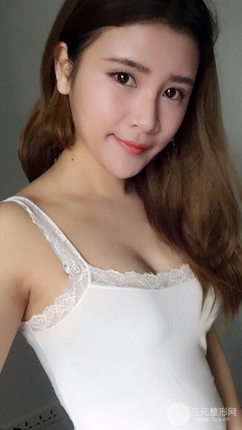 淄博阳光整形自体脂肪隆胸前后对比图，真实案例