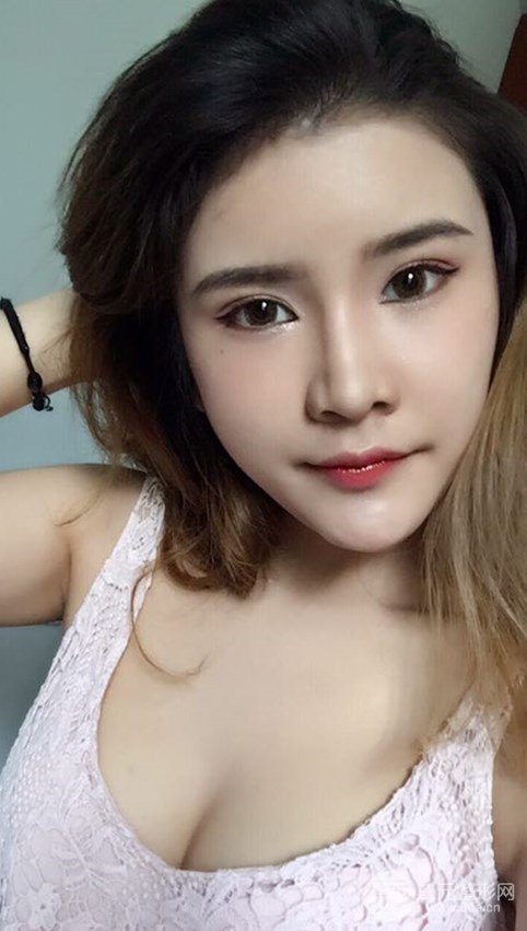 淄博阳光整形自体脂肪隆胸前后对比图，真实案例