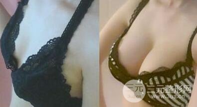 假体隆胸后男朋友摸得出吗？隆胸果自然吗？隆胸果图