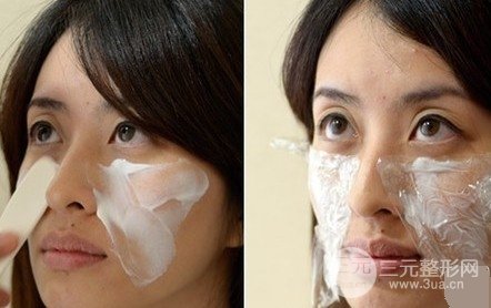 “人未老，皱先行”，注射除皱面部年轻化修复过程