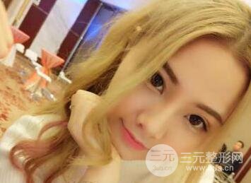 开内眼角和三点定位双眼皮恢复过程图片真人案例分享