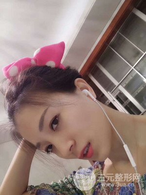 分享我的激光祛眼袋手术前后过程，厦门思明安黛美林韵医生做的