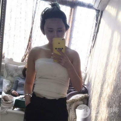 温州友好医院尹建祥自体脂肪隆胸真人案例分享