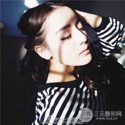 温州友好医院尹建祥隆鼻整形真人案例分享