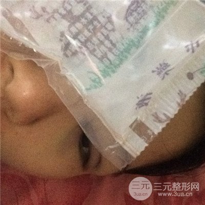 济南曹博士美容医院曹景敏眼部综合整形真人案例分享