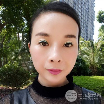 济南曹博士美容医院曹景敏埋埋蛋白线.提升真人案例分享