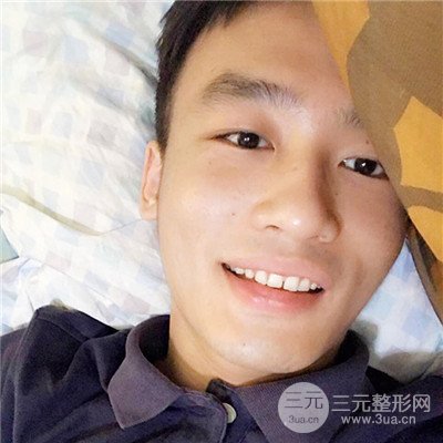 济南曹博士鲁开化祛痘坑痘印真人案例分享