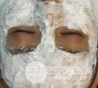 水光补水嫩肤果图前后对比和恢复过程真实案例分享