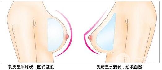 硅胶假体丰胸可靠性高吗？果好不好？