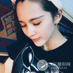 隆鼻整形多少钱 李圣利隆鼻整形案例