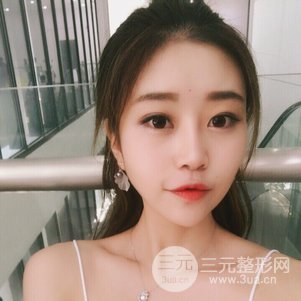 上海九院鼻部韩式生科芭比线条修复