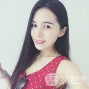 切开双眼皮前后对比图 美联致美切开双眼皮恢复过程