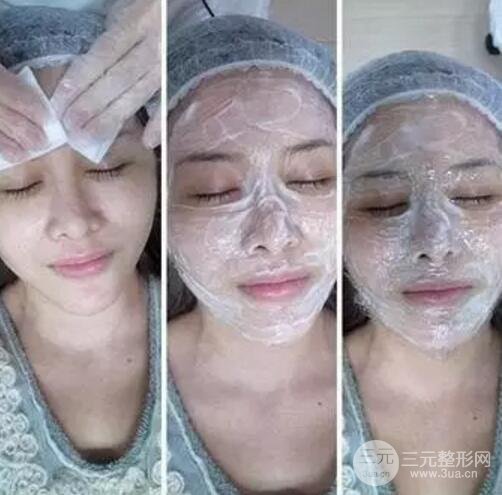 我做了光子嫩肤几天起而且价格便宜前后对比照片案例