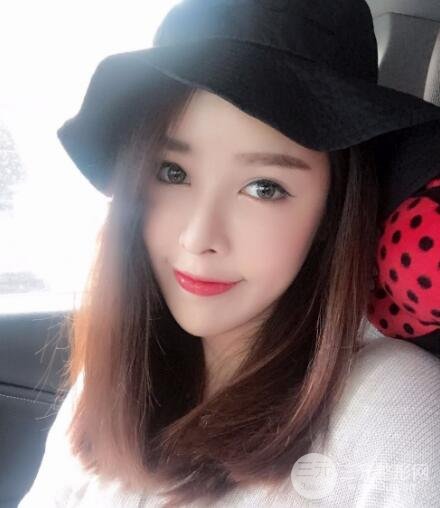 大腿抽脂做脸部脂肪填充 包括太阳穴和额头价格果分享