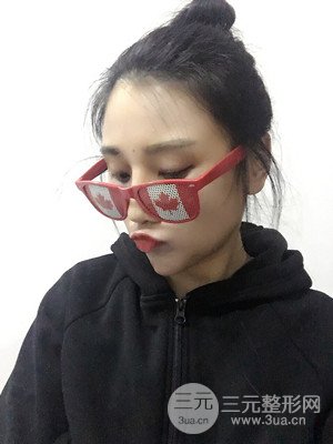 珠海莱茵门诊部马中卫隆鼻整形案例分享，并附上前后对比照片~