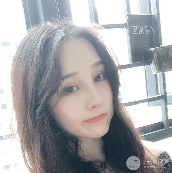 苏州芘丽芙华美甘月圆自体脂肪填充全脸恢复记录