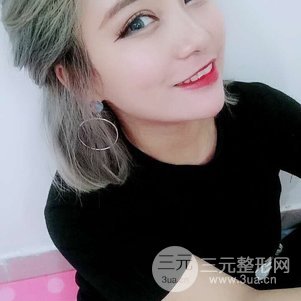 切开双眼皮对比恢复过程图 青岛琅梵亚美妍双眼皮案例