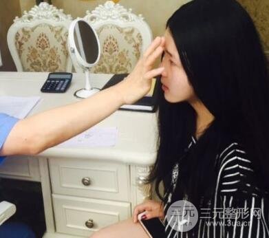 隆鼻整形包括假体隆鼻+耳软骨垫鼻尖+鼻小柱延长