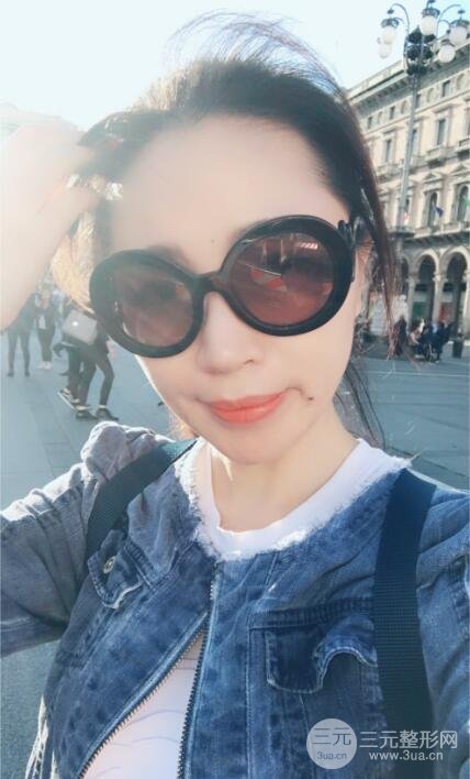 面b提升术多少钱?价格和案例分享