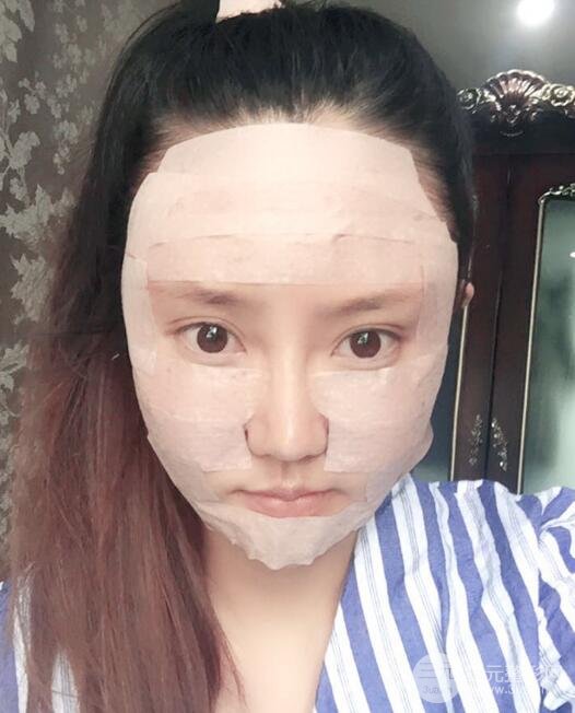 自体脂肪面部填充价位和案例