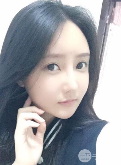 自体脂肪面部填充价位和案例