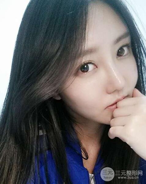 自体脂肪面部填充价位和案例