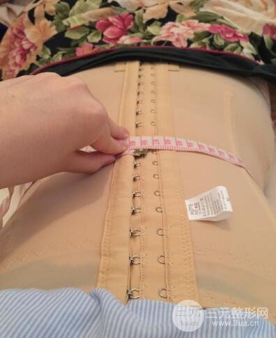 腹部抽脂价格和恢复案例