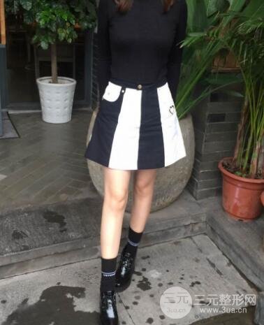 腹部抽脂价格和恢复案例