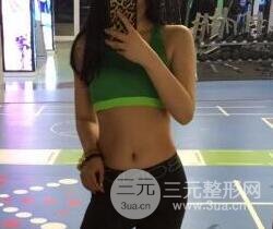 腹部抽脂价格和恢复案例
