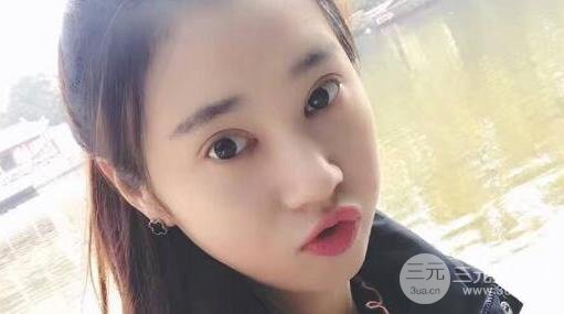 切开双眼皮+开内眼角案例