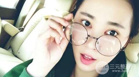 切开双眼皮+开内眼角案例