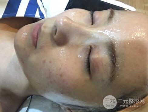 注射水光补水价格和案例图片