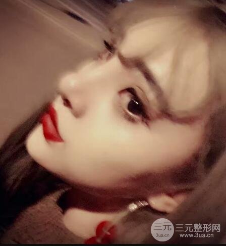 上海鼻子整形专家、价格和案例