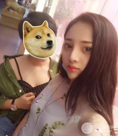 上海鼻子整形专家、价格和案例