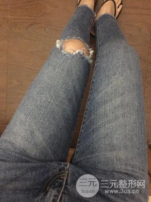 珠海莱茵门诊部卢刚给我做的大腿抽脂手术，前后对比图分享