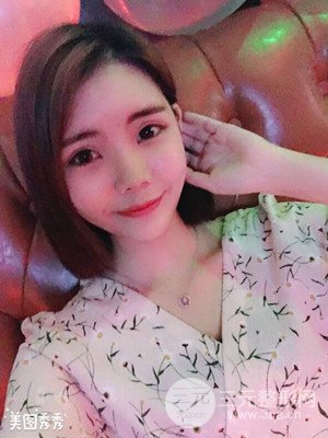 自体脂肪填充全脸真实案例——济南爱容张庆国医生做的