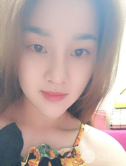 蒜头鼻整形价格和对比照片案例