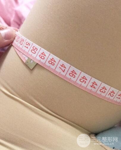 大腿环吸抽脂价格和图片案例